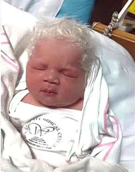 This is the adorable name she's dubbed the whitest of platinum blonde dye surprisingly, jewel says the overall process of creating baby white hair isn't particularly hard, as long. Baby boy born with snow-white hair dubbed "Prince Charming"