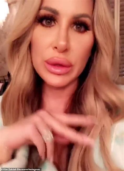 kim zolciak 40 gets viciously trolled on social media again for ridiculous lip injections