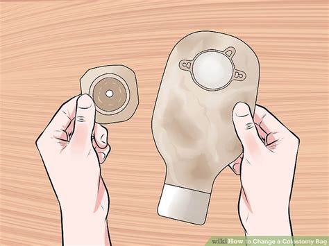 How to Change a Colostomy Bag: 12 Steps (with Pictures ...