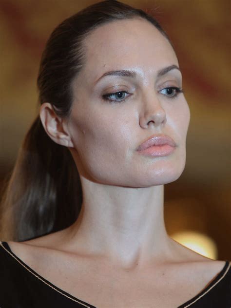 Angelina Jolies Mastectomy Decision And Weighing Cancer Risks Shots