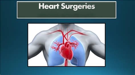 Ppt Heart Surgeries Powerpoint Presentation Free Download Id7327467