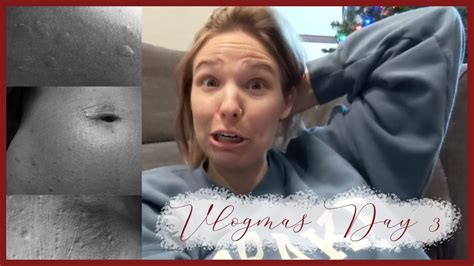 Allergic Reaction To Ct Scan Contrast Vlogmas Day 3 Youtube