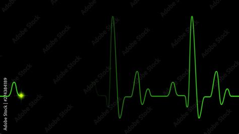 Green Heart Pulse Graphic Line On Black Healthcare Medical Animation Of EKG Heart Beat With