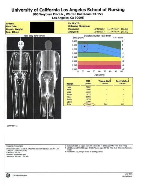 A bone density scan is used to measure how much bone tissue you have. My DEXA Scan for Body Composition - BJJ Caveman