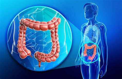 If an internal link led you here, you. Tubulovillous adenoma of colon, causes, symptoms ...