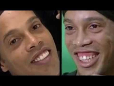 Deschamps est une entreprise internationale exportatrice et innovante. Nouvelles dents de Ronaldinho à 50 000€ - YouTube