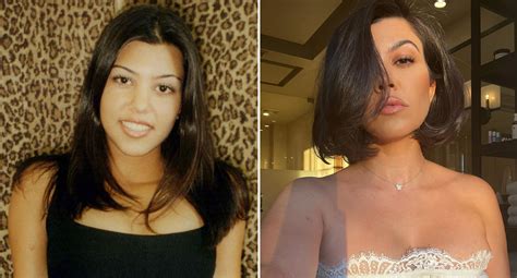 Has Kourtney Kardashian Had Plastic Surgery The Truth About Filler And Implants Who Magazine