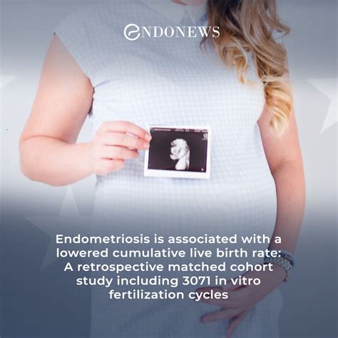 Endometriosis And The Cumulative Live Birth Rate In Ivf Cycles Endonews