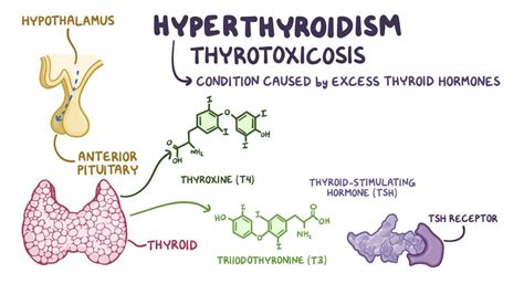 Hyperthyroidism Clinical Video Anatomy Definition Osmosis