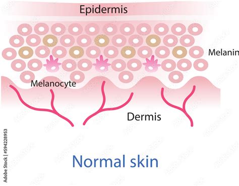 Normal Skin Layer Vector Melanocyte Melanin Melanogenesis Vector On