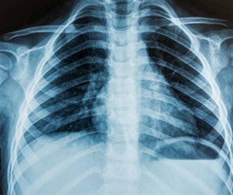 Pin On Radiology Radiologija Riset