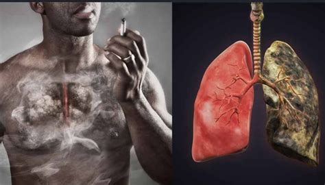 Using other tobacco products such as cigars or pipes also increases the risk for lung cancer. Will a smoker's lungs clean themselves if they quit ...