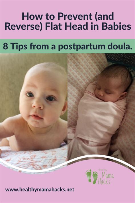 Plagiocephaly How To Prevent Flat Head In Babies Healthy Mama Hacks