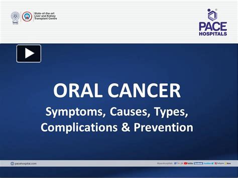 Ppt Oral Cancer Symptoms Causes Stages Risk Factors
