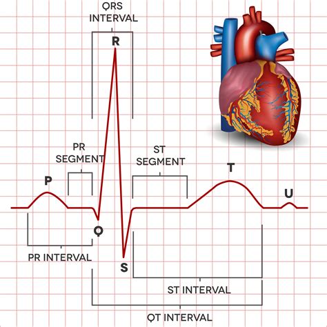 Como Interpretar Um Eletrocardiograma Edubrainaz