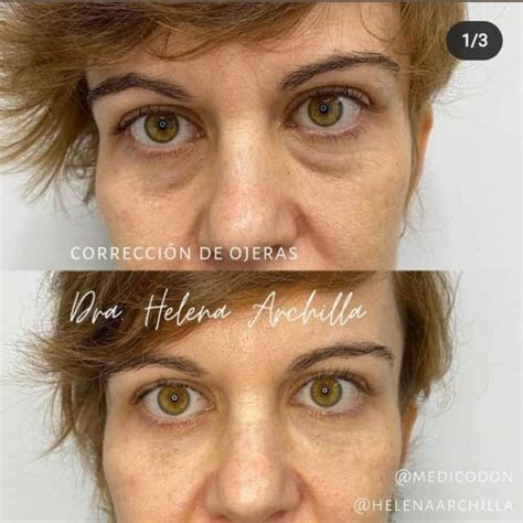 Simple Science: How to Make a Volcano with Kids