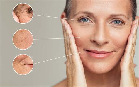 Fine Lines And Wrinkle Treatment Complete Skin Solutions Rockhampton