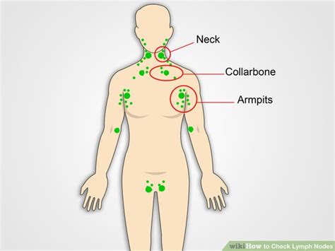 Armpit Lumps And Pain