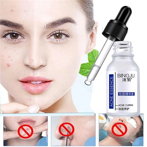 Dropship Tonifying Soothing Nourishes Acne Removing Facial Acne