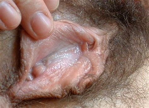Connies Close Up Cunt And Anus 50 Pics Xhamster