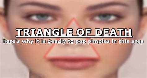 Popping Pimples In The Triangle Is Deadly Heres Why