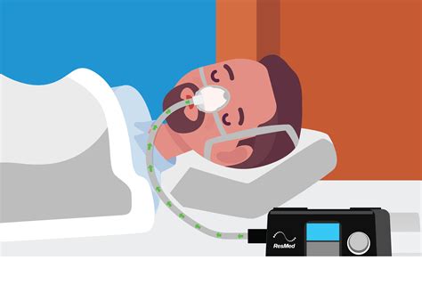 How To Adjust Pressure On A Sleep Apnea Machine Sleepation