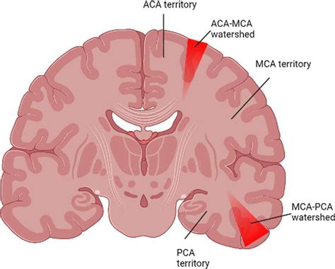 Anatomical Area Of The Brain With Watershed Zones Aca Anterior