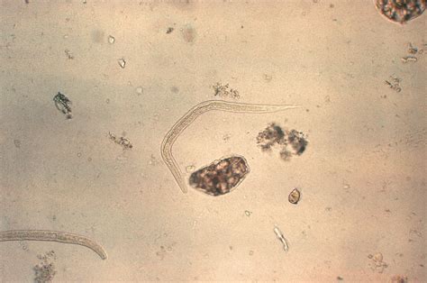 Public Domain Picture This Micrograph Depicts A Strongyloides
