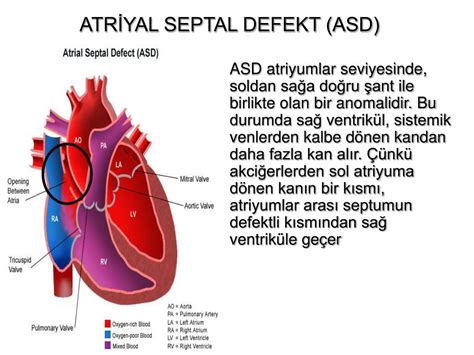 Nabız sayısının belirlenmesi hem oldukça kolay bir işlemdir hem de kişinin sağlık durumuyla ilgili çok önemli bilgi sağlayabilir. PPT - KONJENİTAL KALP HASTALIKLARI VE CERRAHİSİ PowerPoint ...