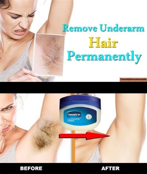 How To Remove Underarm Hair Permanently Is A Very Common Question