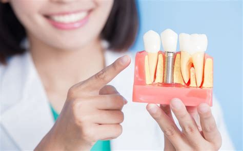 What Is The Cost And Procedure For Dental Implant Healthy Smiles