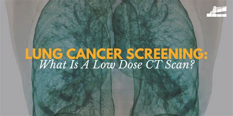 Lung Cancer Screening What Is A Low Dose Ct Scan Bay Imaging Consultants