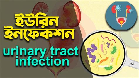 Urinary Tract Infection Overview Signs And Symptoms Pathophysiology Causes And Treatment