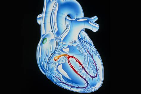 4 Steps Of Cardiac Conduction