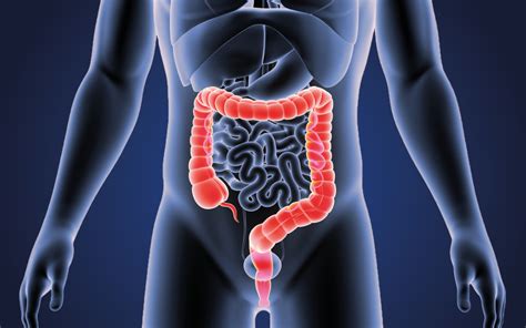 Colorectal Cancer How To Prevent And Improve The Survival Outcomes