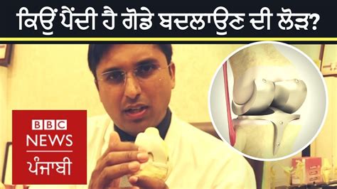 Knee Replacement How It Is Performed Bbc News Punjabi Youtube