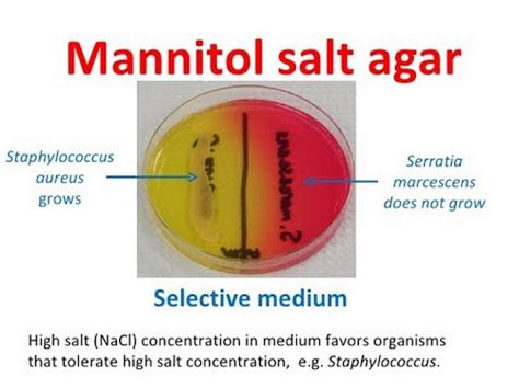 Mannitol Salt Agar Plate Test Composition Preparation Uses