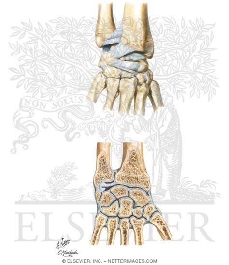 Ligaments Of The Wrist Clipart Etc Images
