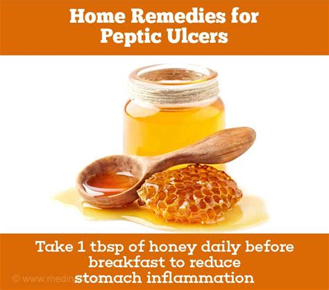 Home Remedies For Peptic Ulcer Stomach Ulcer
