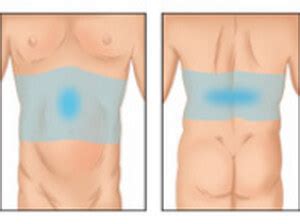 I have a devastating diagnosis to give you, the surgeon said. Right, Left and Central Abdominal Pain