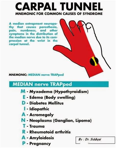 Knowledge Update Mnemonic For Carpal Tunnel