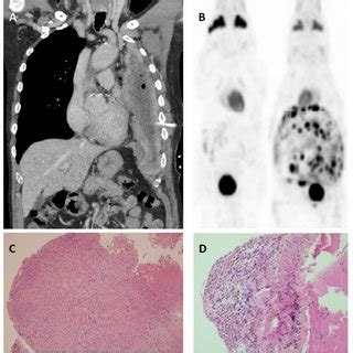 Check spelling or type a new query. (PDF) Mouse models of mesothelioma: Strengths, limitations ...