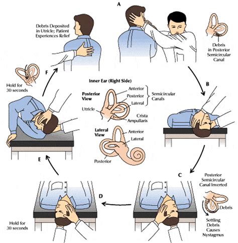 Common Conditions Archives Complete Care Physiotherapy