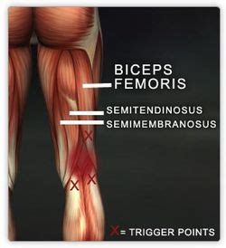 Anatomy/Muscle List - Science Olympiad Student Center Wiki