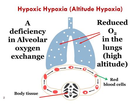 Ppt Types Of Hypoxia Powerpoint Presentation Free Download Id 6378560