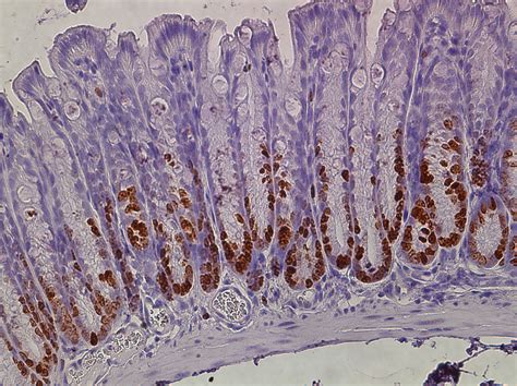 Ki-67 Staining in the Intestine - Chang Lab - University of Chicago