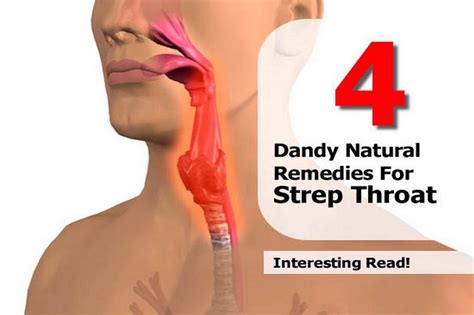 4 Dandy Natural Remedies For Strep Throat