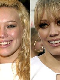 But i just knew i was never doing that. Kirsten Dunst Plastic Surgery Before And After Teeth ...