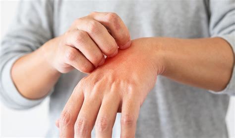 10 Most Common Skin Diseases Causes Symptoms And Treatment Torus