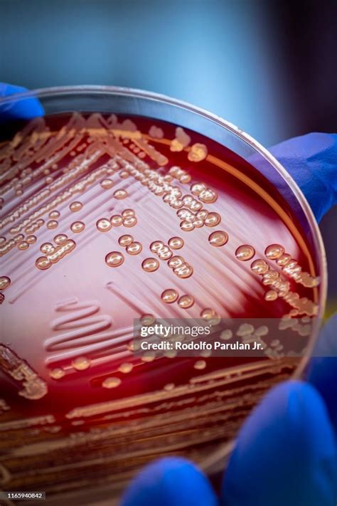 Mrsa On Blood Agar Plate High Res Stock Photo Getty Images
